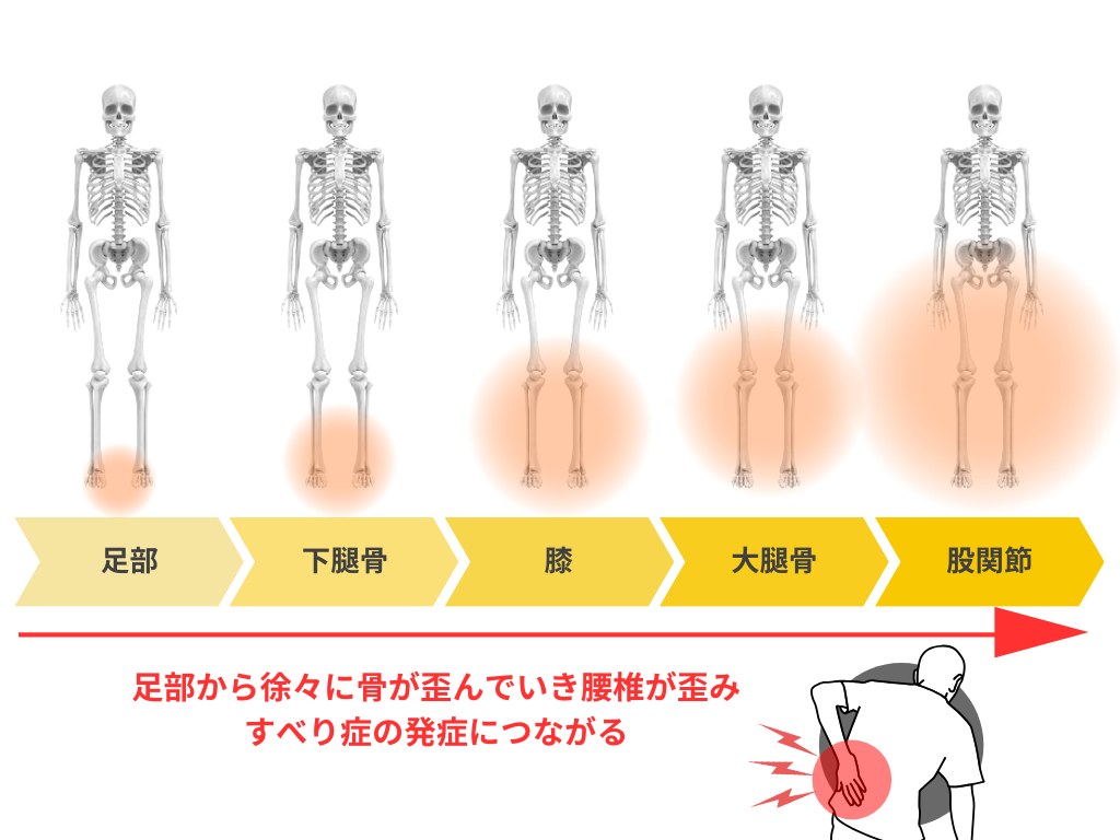 すべり症の発症